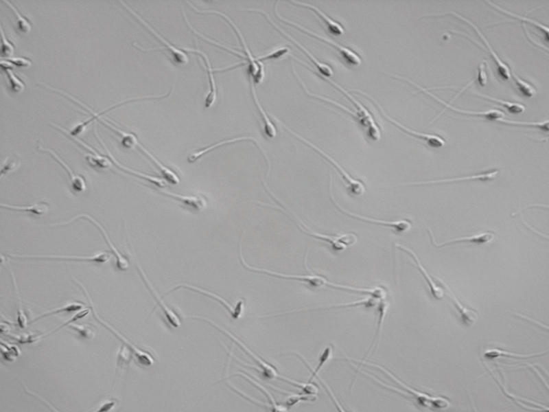Laboratory semen analysis showing sperm motility under a microscope during clinical fertility testing